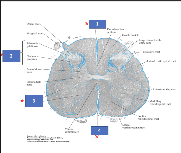 <p>What structure is labeled 1?</p>