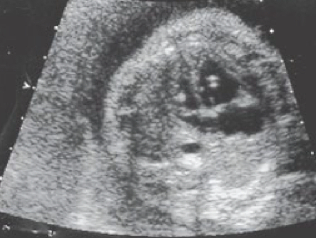 term image