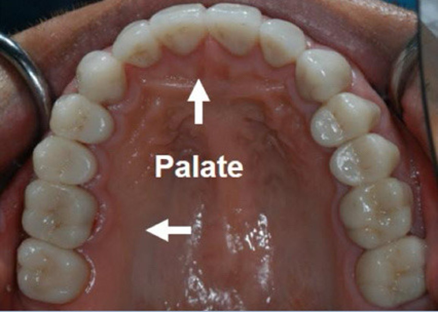 <p>Surface of maxillary teeth nearest to the palate</p>