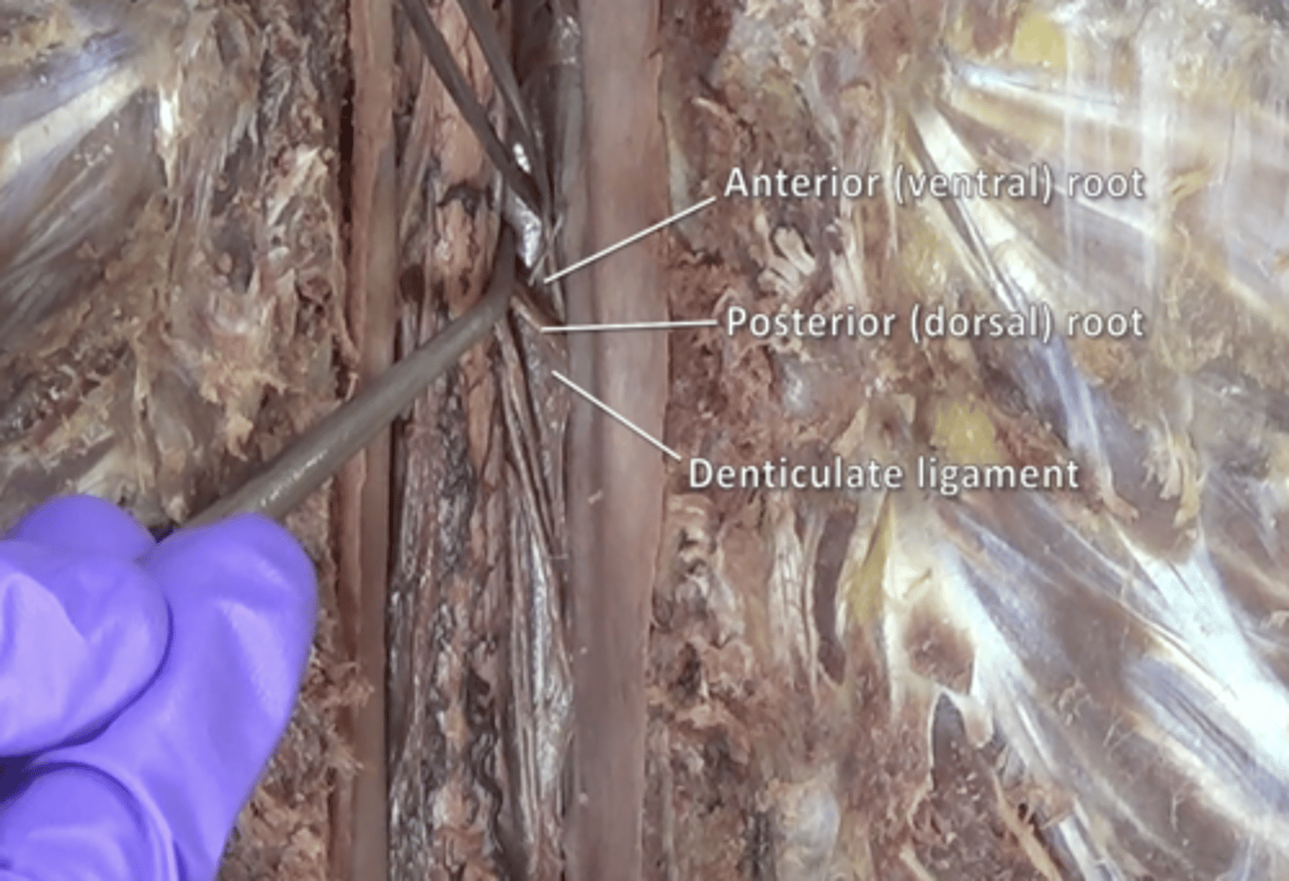 <p>fibers carry motor information located anteriorly to the denticulate ligaments</p>