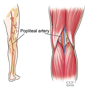<p><span>artery that is primary vascular supply in the region of the knee and lower leg or vein that runs posterior to the popliteal artery and receives blood from multiple tributaries</span></p>