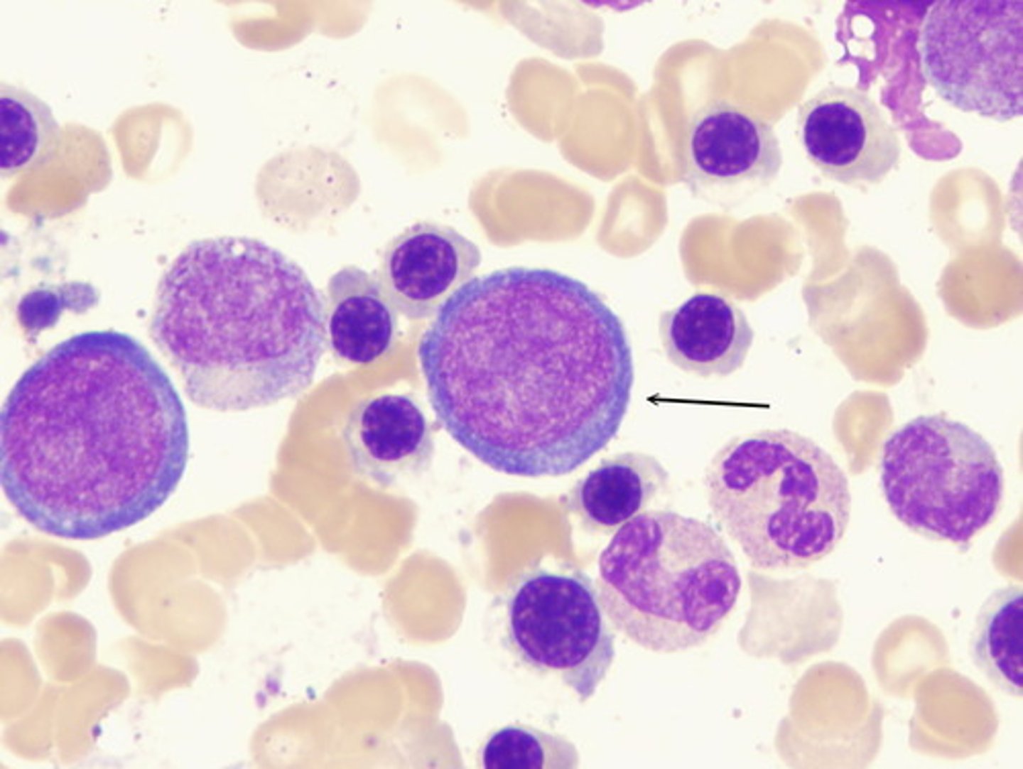 <p>The most immature stage of red blood cell development. Contains one or more nuclei and a basophilic cytoplasm.</p>