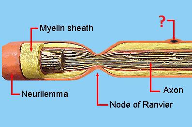- a myelin-secreting glial cell that spirally wraps around an axon of the peripheral nervous system to form the myelin sheath.
