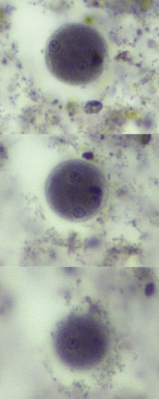 <p>Identify organism and stage</p>