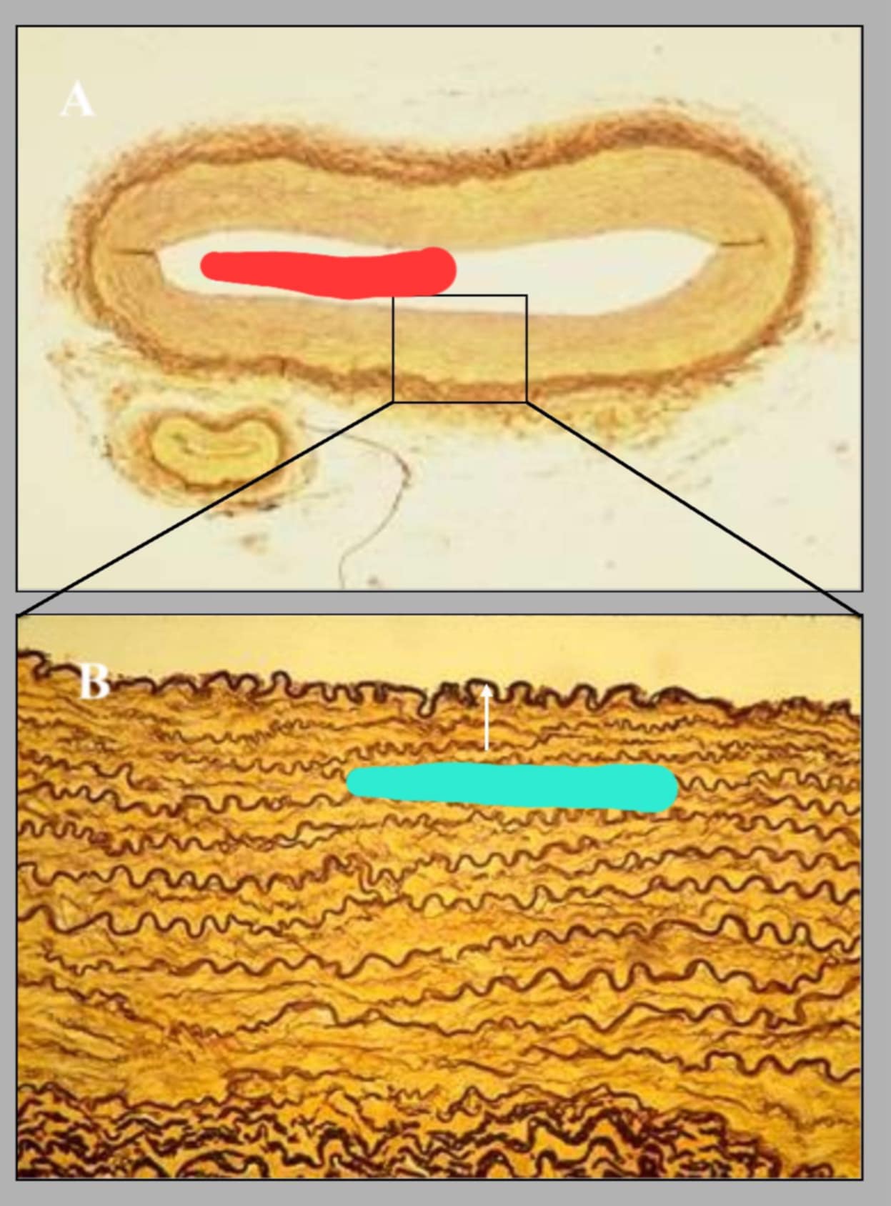 <p>name this slide. state its parts.</p>
