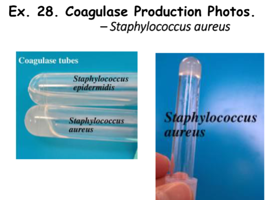 <ul><li><p><strong>Negative Result: </strong>Liquid</p></li><li><p><strong>Positive Result: </strong>Solid</p><ul><li><p><strong>Explanation: </strong>This bacteria produces <span style="background-color: transparent; font-size: 1.6rem;"><span>coagulace and clots plasma (</span></span>which is liquid due to anticoagulant). Confirmatory test for staph.</p></li></ul></li></ul><p><strong>*Tilt when observing tubes.</strong></p><img src="https://media.discordapp.net/attachments/1410353846429028375/1435439222730395660/PHOTO-2025-11-03-12-59-08.jpg?ex=690ca133&is=690b4fb3&hm=d4a495446bb7b689facb859d597259e960aff110e6b5e14b37cd7ba8139f72a1&=&format=webp&width=365&height=649" data-width="100%" data-align="center" alt="Image"><img src="https://media.discordapp.net/attachments/1410353846429028375/1435439225033068629/PHOTO-2025-11-03-12-58-42.jpg?ex=690ca134&is=690b4fb4&hm=b8416208d00af2b72de098d6e105fb81d976da420f014c739925595323bd3778&=&format=webp&width=365&height=649" data-width="100%" data-align="center" alt="Image"><p>*Top = Negative Result; Bottom = Positive Result</p>