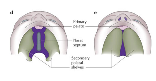 <p>It is formed by the fusion of : </p><ul><li><p>primary palate (intermaxillary segment)</p></li><li><p>secondary palate</p></li><li><p>nasal septum</p></li></ul><p></p>