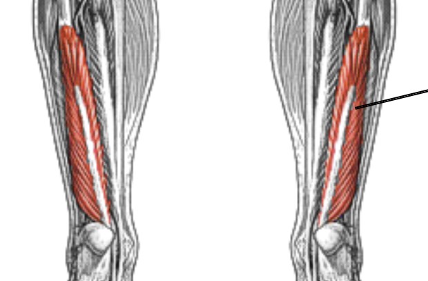<p>Which muscle of the foot/ankle is:</p><ul><li><p>On posterior side</p></li><li><p>Lateral to flexor digitorum longus</p></li><li><p>Action: flex big toe</p></li><li><p>Nerve: <span style="color: yellow;"><span>tibial</span></span></p></li></ul><p></p>
