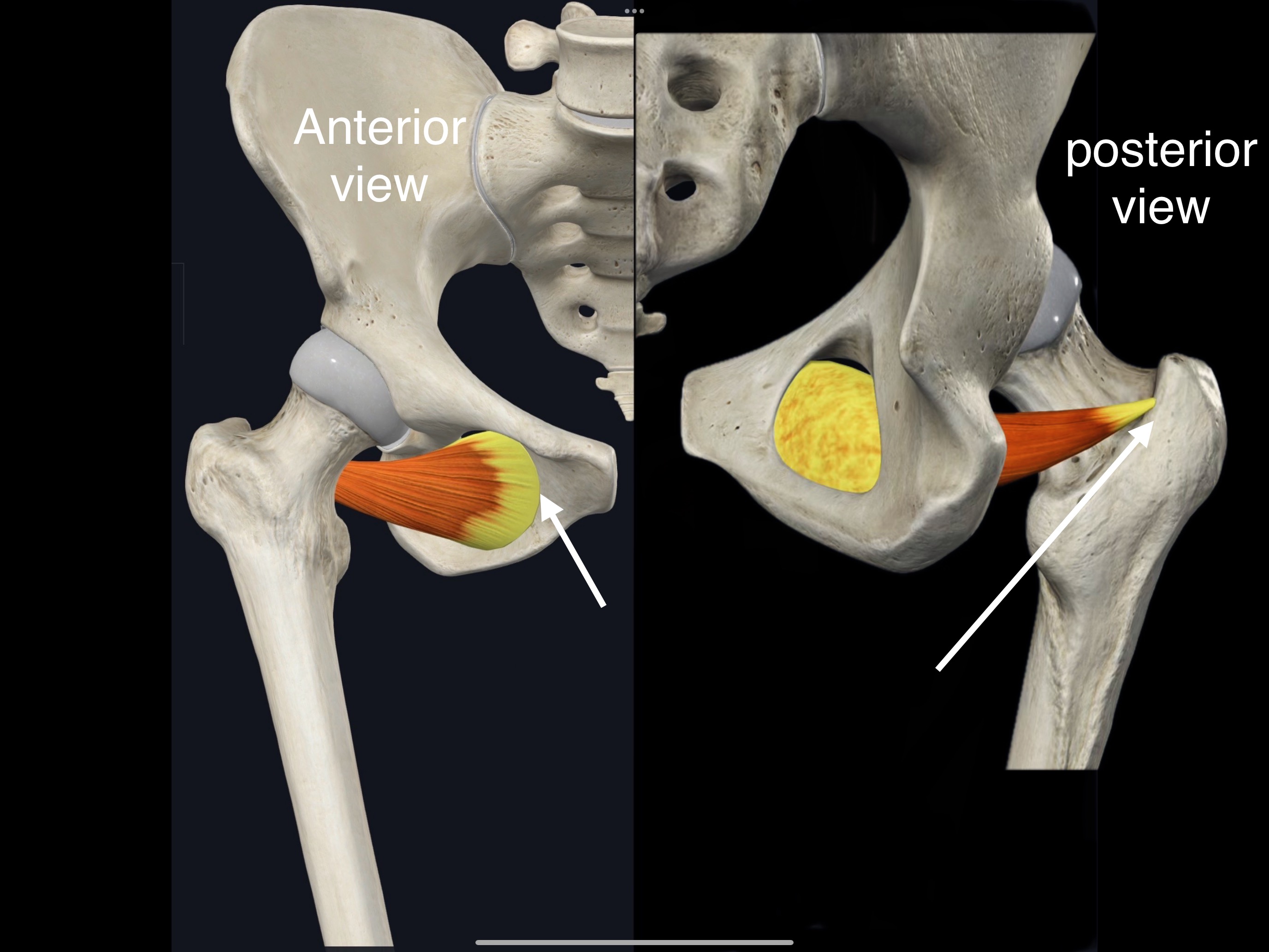 <p>Name the muscle, origin and insertion</p>