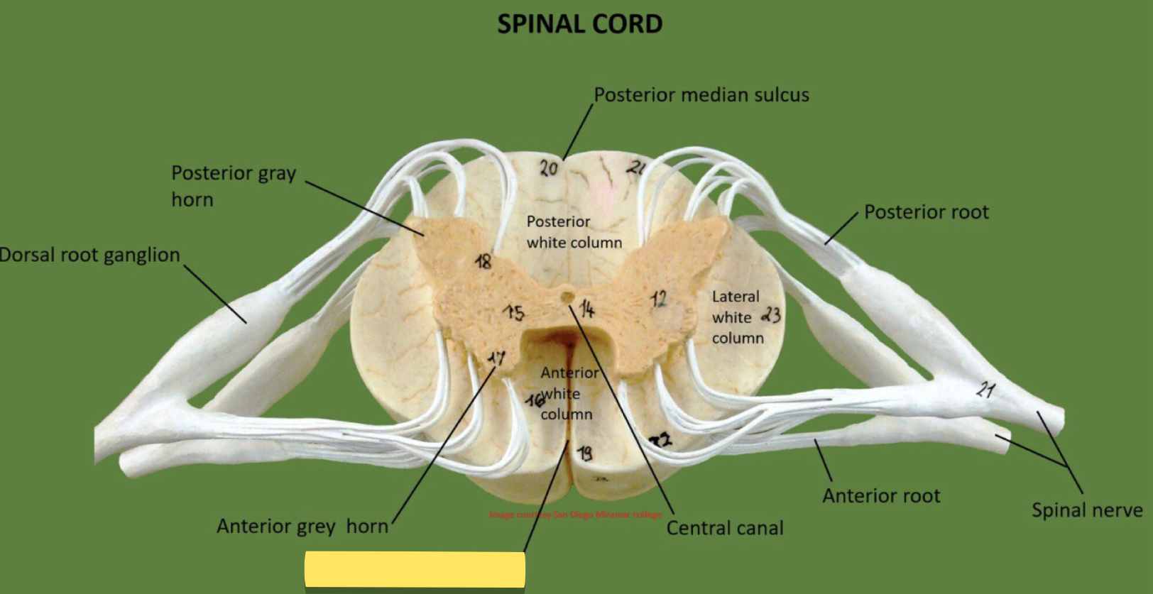 <p>Name this spinal cord part</p>