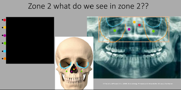 <p>What do we see in Zone 2?</p>