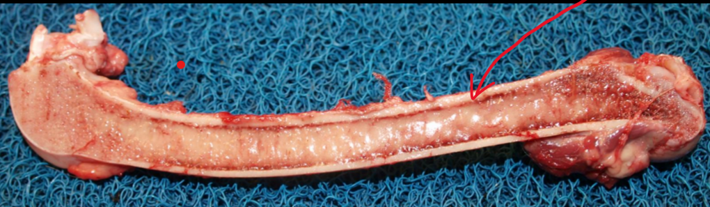 <p>What is this, and what causes it</p>