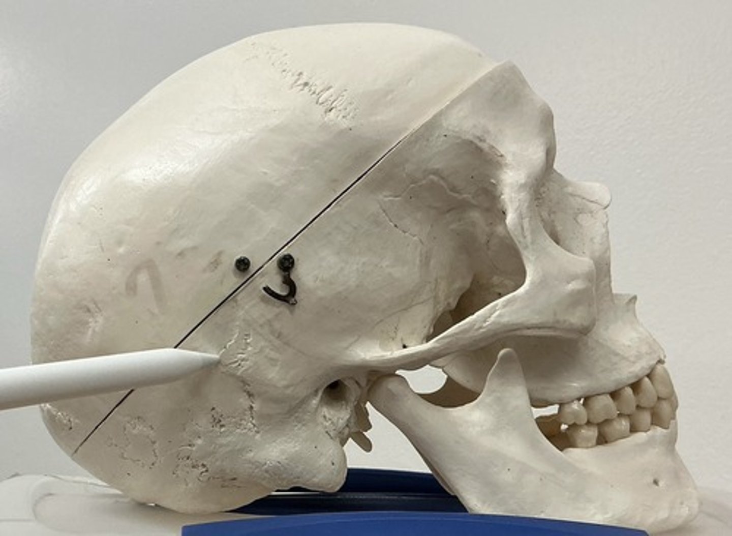 <p>What is the arrow pointing to?</p>