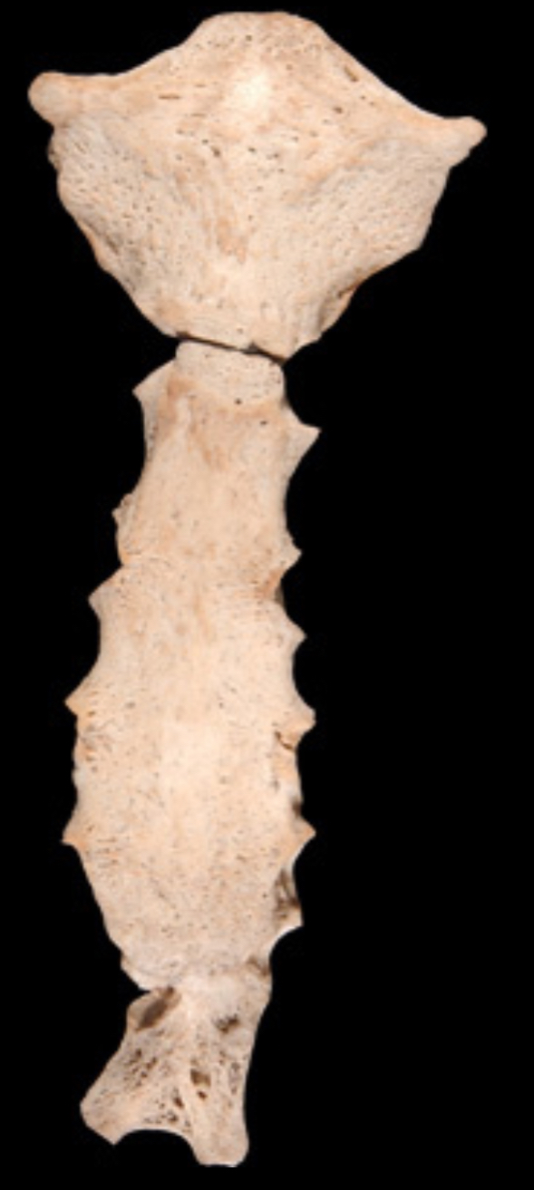 <p>What is this bone?</p>