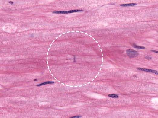 <p>junction btwn adjacent schwann cells surrounding axons</p>