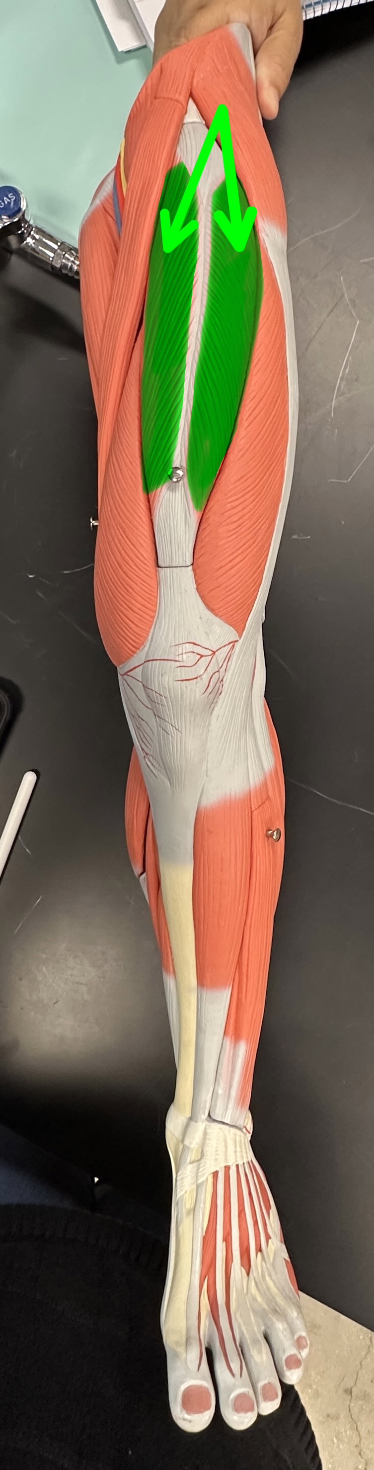 <p>What is the highlighted structure</p>