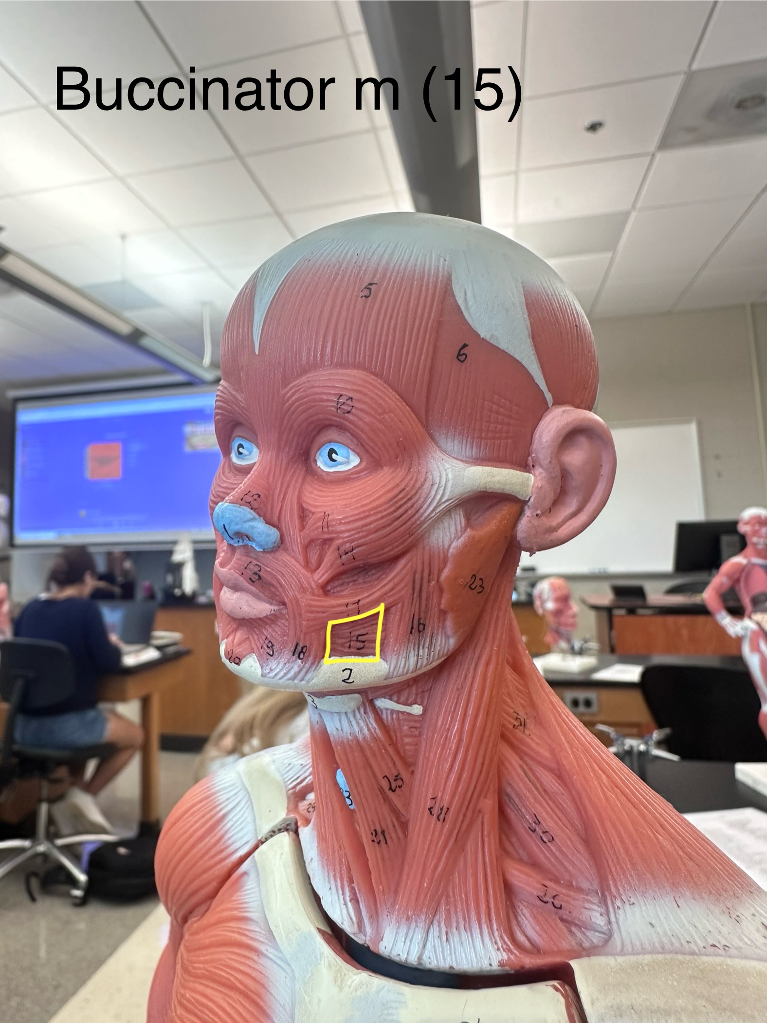 <p>Buccinator muscle</p>