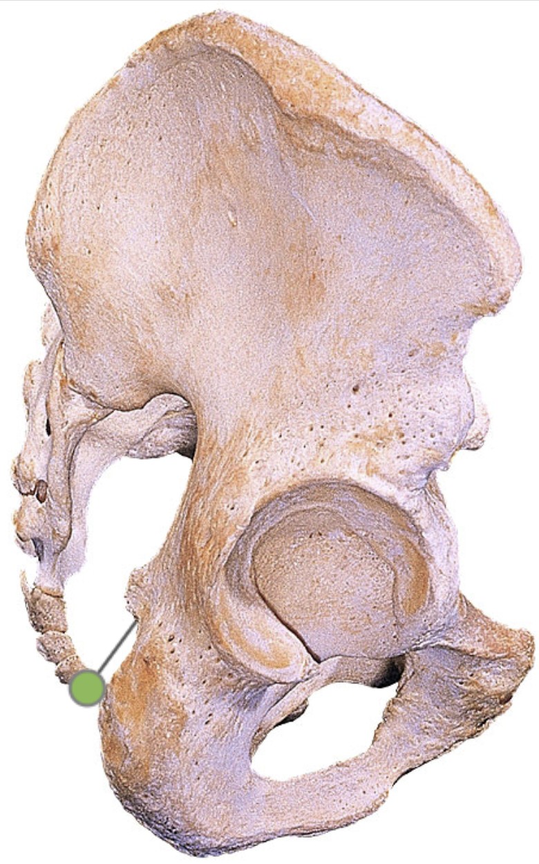 <p>Which bone landmark of the pelvic girdle is a small indentation located on the posterior border of the ischium bone, inferior to the ischial spine?</p>