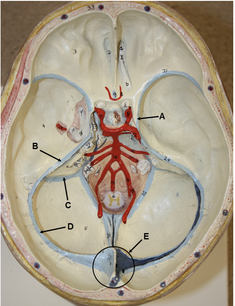 <p><span><span>In the image above (superior view of cranium with calvaria and brain removed), identify dural sinuses A-E.</span></span></p>