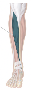 <ul><li><p>Dorsiflexion of the foot</p></li><li><p>Inversion of foot</p></li></ul><p></p>