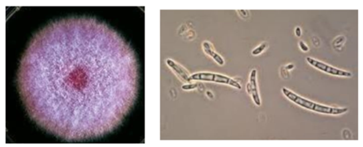 <p>· Common contaminant: mycotic keratitis (#1), disseminated disease</p><p>· Maturity in about 4 days (quick grower)</p><p>· Cottony surface, develops violet or pink center with light periphery; reverse light; inhibited by cycloheximide</p><p>· Canoe-shaped macroconidia ± 1 to 2-celled conidia in clusters</p>