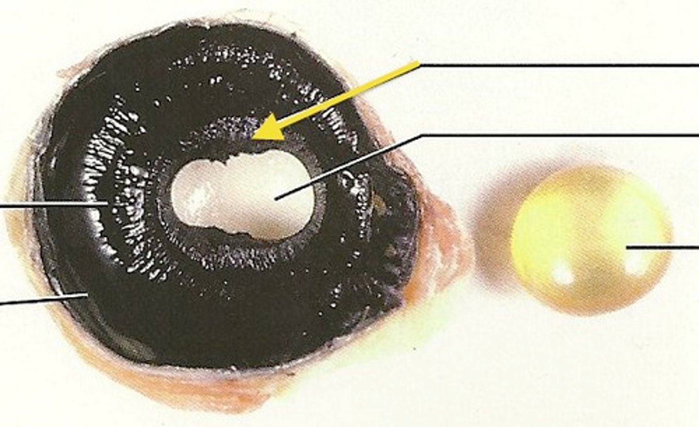 <p>the colored part of the eye.</p>