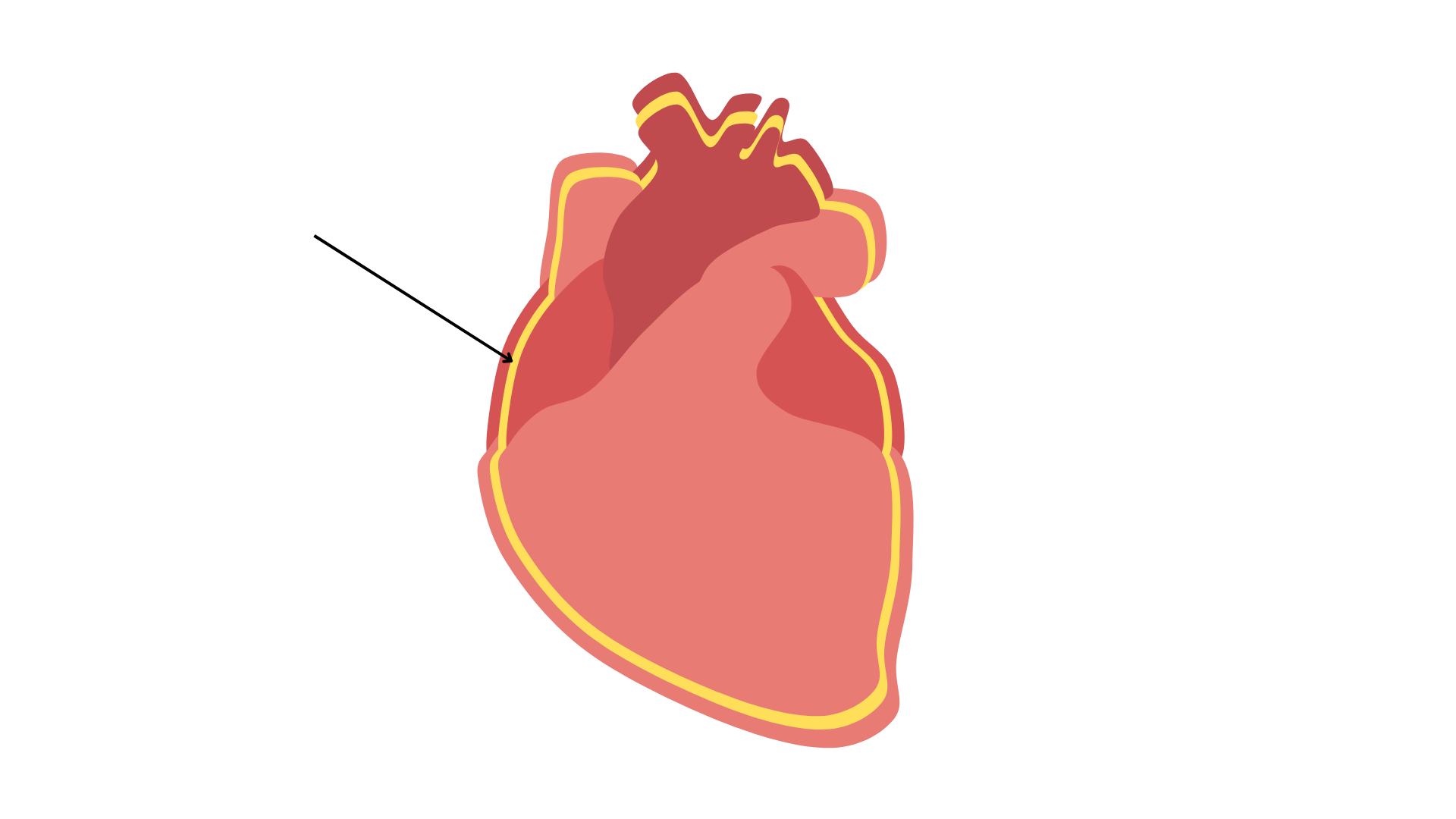 <p>Pericardial Cavity </p>
