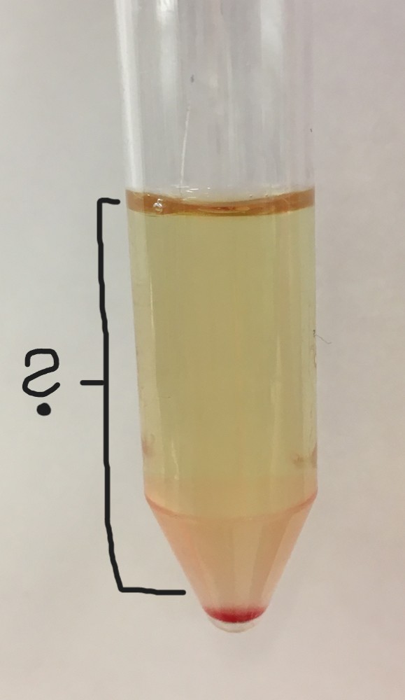 <p>What is this section of this centrifuged urine sample?</p>