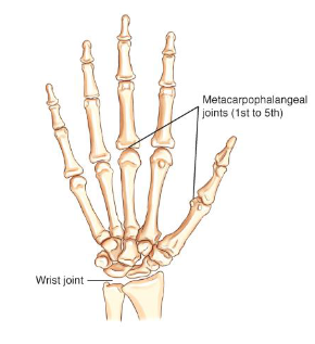 <p>condyloid — allows for adduction and abduction as well as flexion and extension</p>