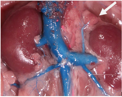 <p>Small, triangular-shaped glands located on top of each kidney. They produce hormones that regulate metabolism, stress response, electrolyte balance, and blood pressure.</p>