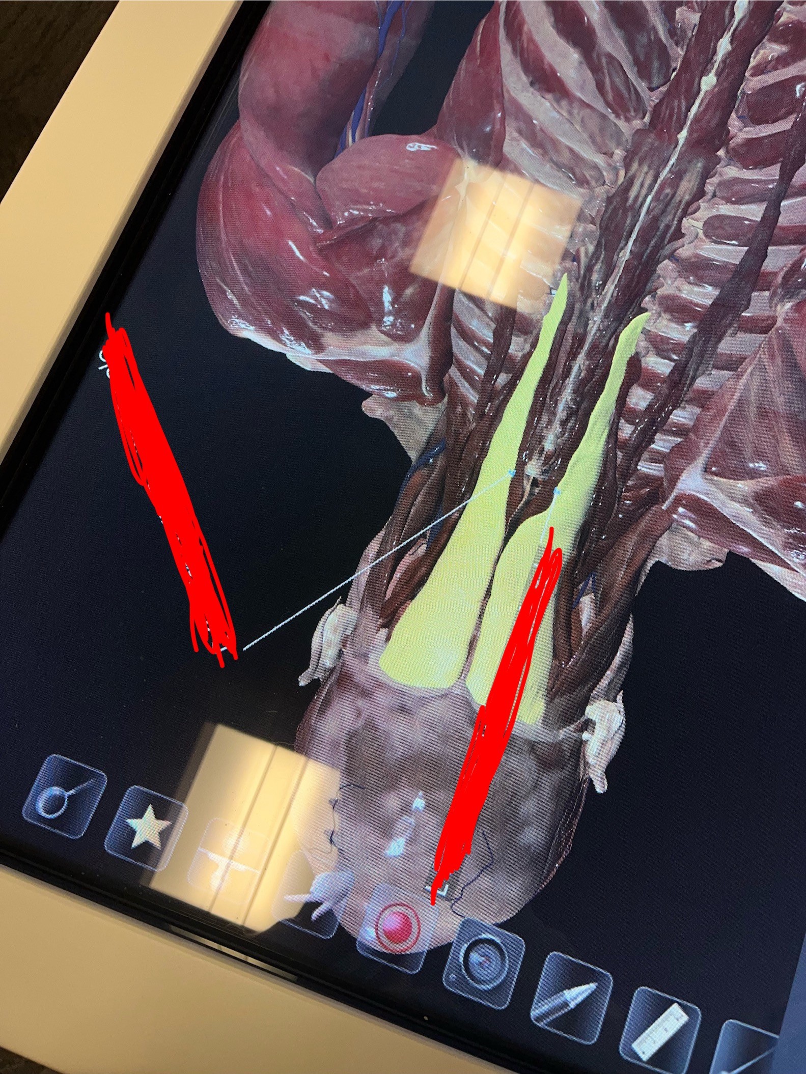 <p>What spinal muscle is this</p>