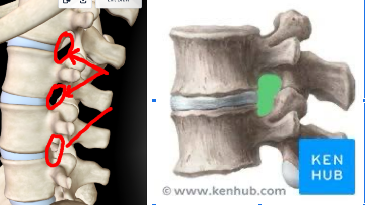 <p><strong>HOLES BETWEEN EVERY VERTEBRAE </strong></p>