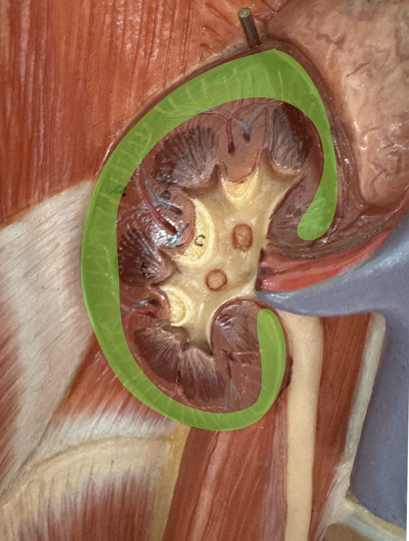 <p>What is the picture of?</p>