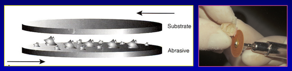 <p>what is two-body abrasion </p>
