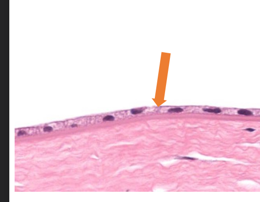 <p>what tissue is this</p>
