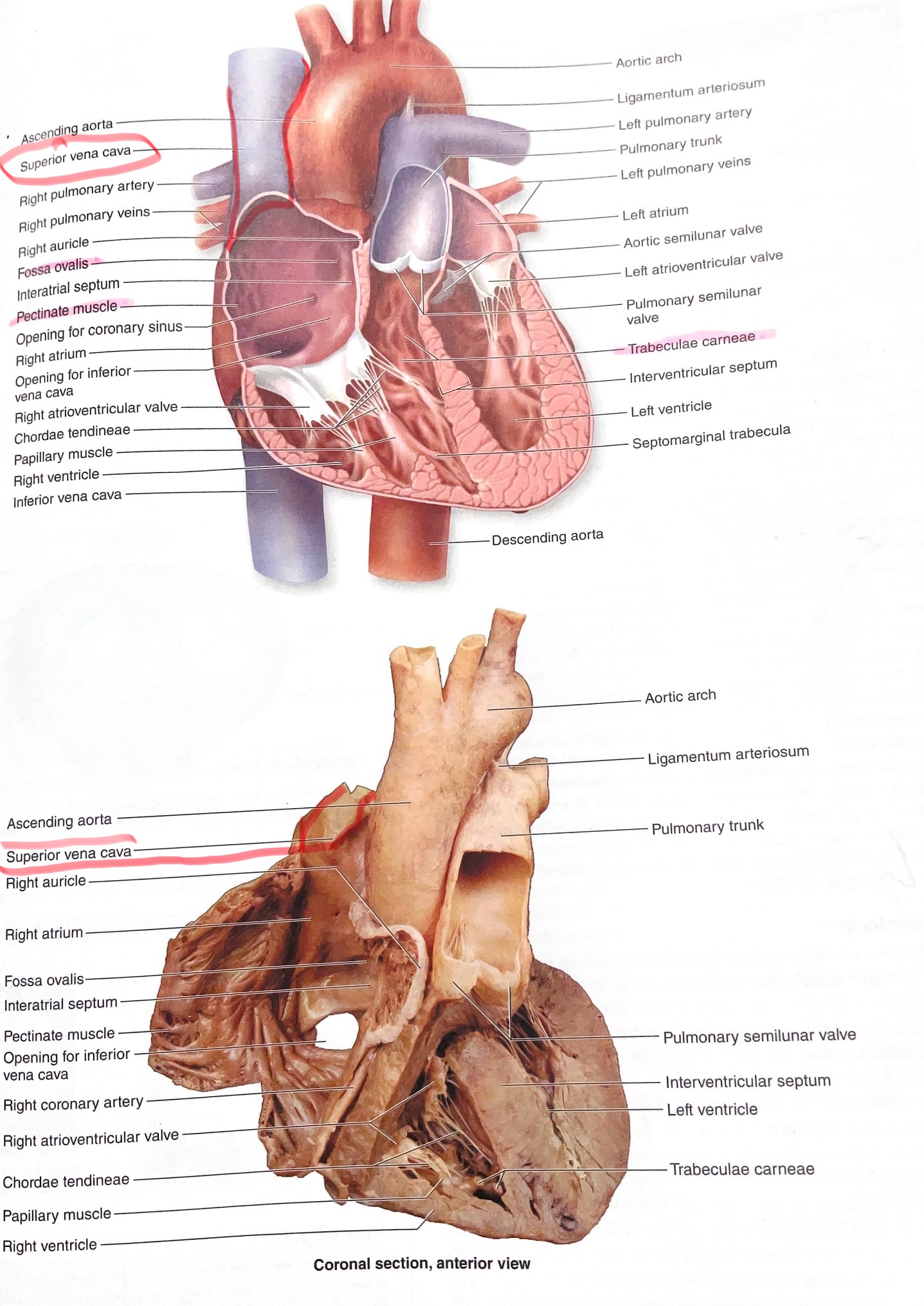 <p>Vein returning blood from head, neck, and upper limbs to right atrium.</p>