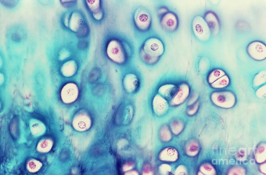 <p>Hyaline (Cartilage) </p>