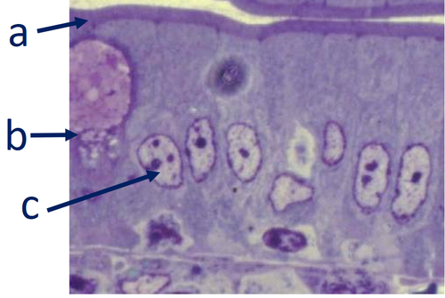 <p>Which cellular structure(s)/cell(s) of epithelium do not/does not match the image(s) in these cells?</p><p>a- Basement membrane</p><p>b- Goblet cell</p><p>c- Nucleus of cell</p><p>A and B</p><p>A, B, and C</p><p><br></p>