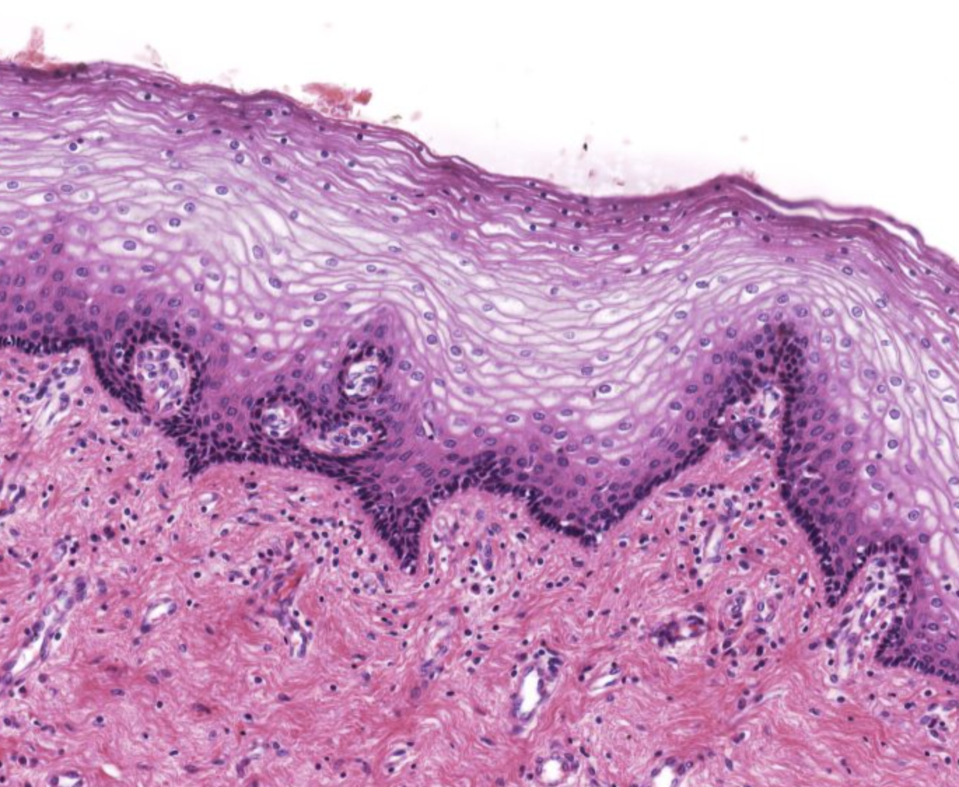 <p><strong><u>Epithelium:</u></strong> <span style="color: green;"><strong>Non keratinized straitified squamous </strong></span></p><p><strong><u>Describe the connective tissue:</u> </strong><span style="color: green;"><strong>Loose</strong></span> or<strong> </strong><span style="color: green;"><strong>dense CT</strong></span></p><p><strong><u>Lack of:</u> </strong><span style="color: green;"><strong>Glands</strong></span></p><p><strong><u>Additional structures:</u> </strong><span style="color: green;"><strong>Lymphooid tissue </strong></span></p><p></p>
