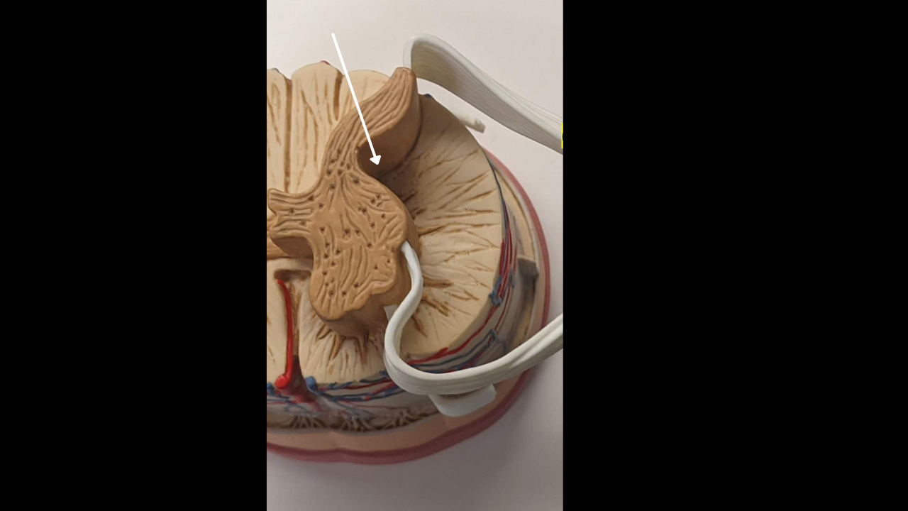 <p>(9) Lateral Horn</p>