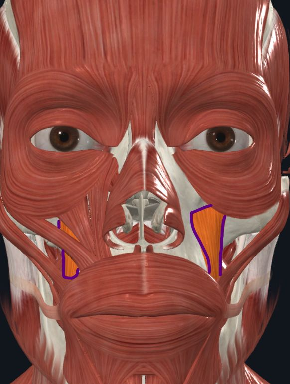 <p><strong>Nombre alterno: </strong>Elevador del ángulo de la boca</p><p><strong><mark data-color="yellow" style="background-color: yellow; color: inherit">Origen: </mark></strong><mark data-color="yellow" style="background-color: yellow; color: inherit">Fosa canina del maxilar</mark></p><p><strong><mark data-color="blue" style="background-color: blue; color: inherit">Inserción: </mark></strong><mark data-color="blue" style="background-color: blue; color: inherit">Ángulo de la boca</mark></p><p><strong><mark data-color="red" style="background-color: red; color: inherit">Acción: </mark></strong><mark data-color="red" style="background-color: red; color: inherit">Levanta cuerpo y extremo de labio</mark></p><p><strong><mark data-color="purple" style="background-color: purple; color: inherit">Inervación: </mark></strong><mark data-color="purple" style="background-color: purple; color: inherit">Nervio Facial</mark><strong><br><mark data-color="green" style="background-color: green; color: inherit">Relaciones: </mark></strong><mark data-color="green" style="background-color: green; color: inherit">Agonista de M. Elevador del labio superior</mark></p><p><strong>Notas:</strong></p>