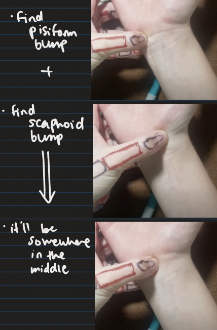 <ul><li><p>find pisiform bump</p></li><li><p>find scaphoid bump</p></li><li><p>it’ll be somewhere in the middle</p></li></ul><p></p>