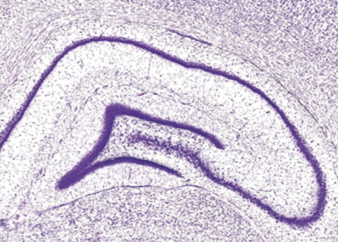 <p>what experimental technique was used in this image?</p>