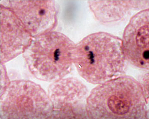 <p>Identify the stage of mitosis</p>