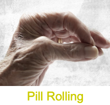 <ul><li><p><strong>Often first sign</strong></p></li><li><p>Initially minimal</p></li><li><p>More prominent at rest</p></li><li><p>Aggravated by</p><ul><li><p>Emotional stress</p></li><li><p>↑ Concentration</p></li></ul></li></ul><p></p>