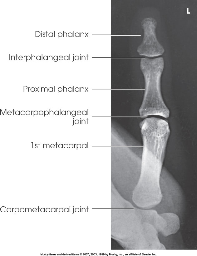 <p>What position is demonstrated?</p>