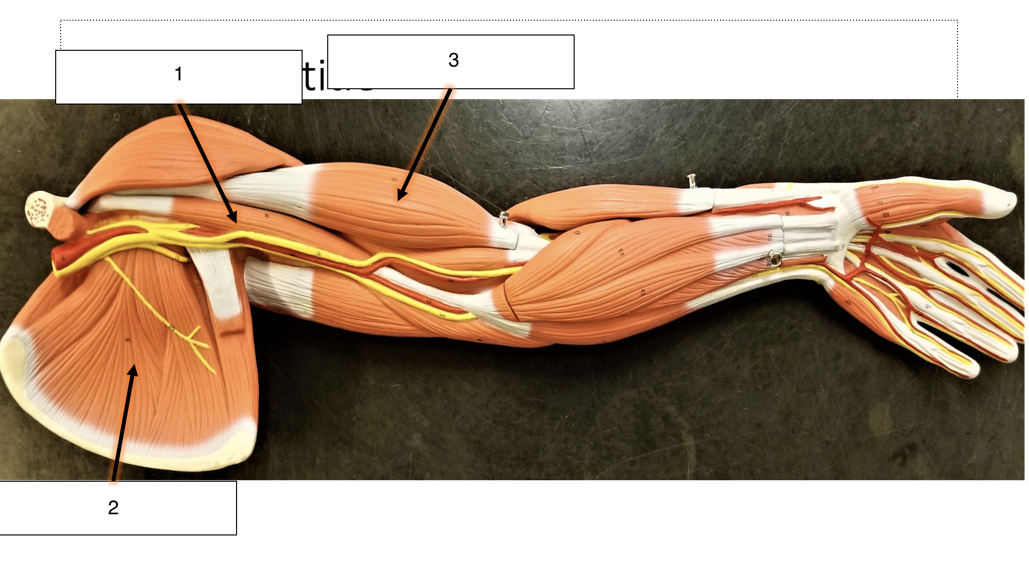 <p>name the muscle (1)</p>