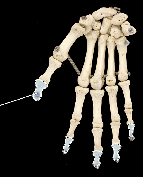 <p>Name this group of bones (be specific).</p><p>(Anterior view, right side).</p>