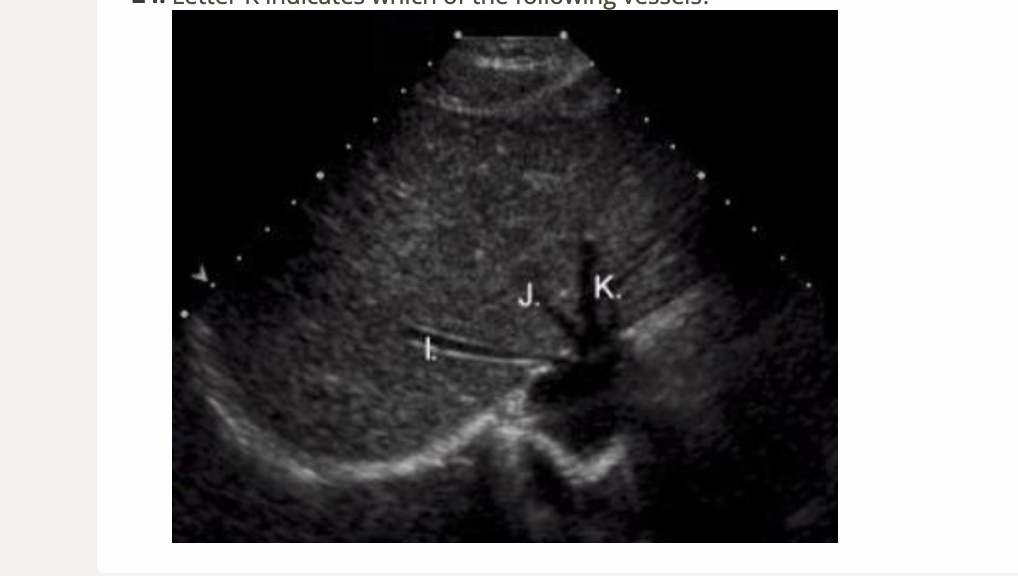 <p>letter K is which vessel</p><p>.</p><p>a) left portal vein</p><p>b) right portal vein</p><p>c) middle hepatic vein</p><p>d) left hepatic vein </p>