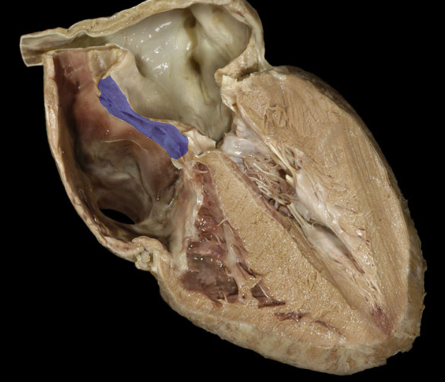 <p>identify the structure</p>